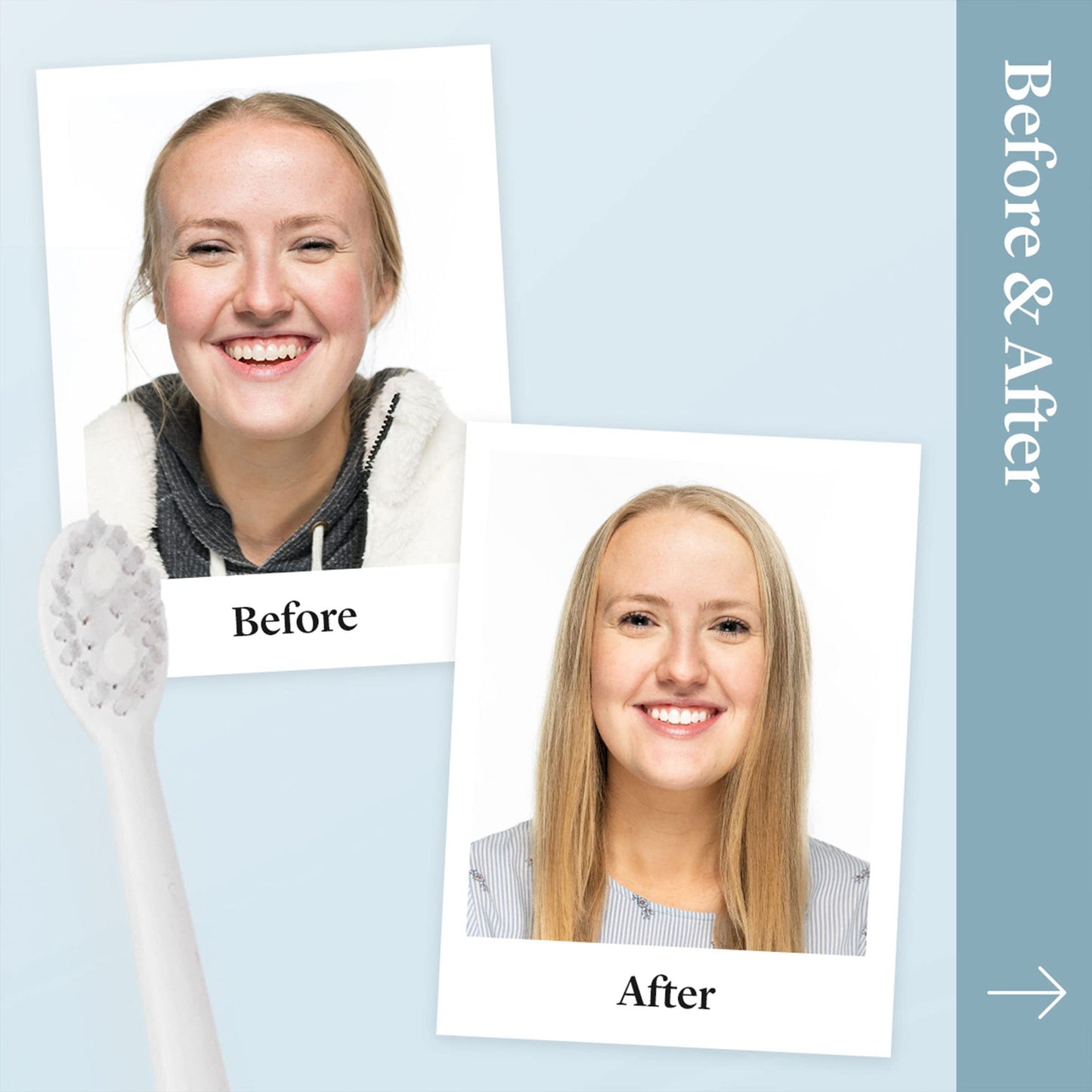 Spotlight Oral Care Sonic Toothbrush | Gentle & Effective Electric Toothbrush | 2-Minute Self Timer | Long Lasting Battery | 3 Speed Settings | Up to 48000 Reps/Min